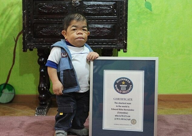 Mažiausias pasaulio žmogaus statusas tik šešioms savaitėms