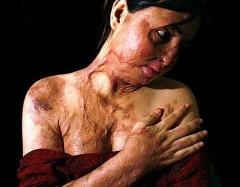 Islamo pasaulyje smurtas prieš moteris – kasdienybė (foto)