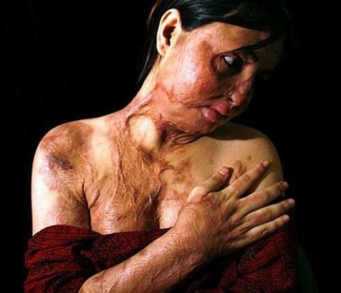 Islamo pasaulyje smurtas prieš moteris - kasdienybė (foto)