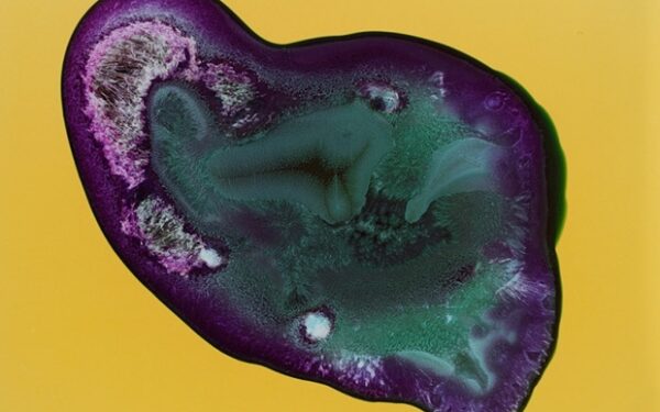 Narkotikų anatomija: heroinas, metas, LSD ir kitos medžiagos – iš labai arti (foto)