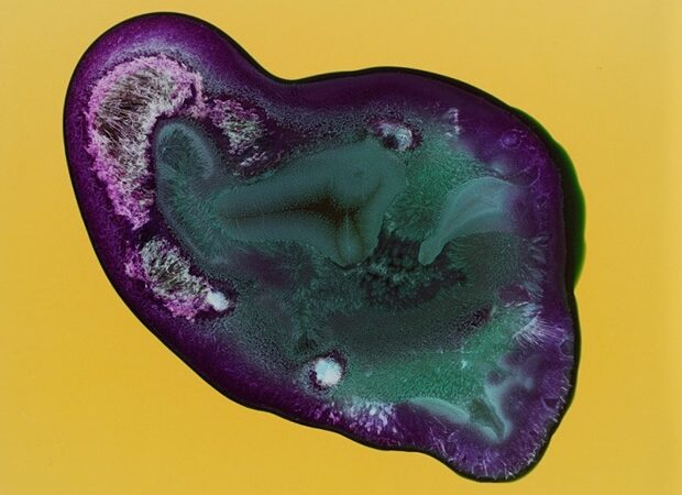 Narkotikų anatomija: heroinas, metas, LSD ir kitos medžiagos – iš labai arti (foto)