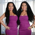 Plastinės operacijos ir identiškas gyvenimas: dvynės stengiasi tapti vienu žmogumi (foto)