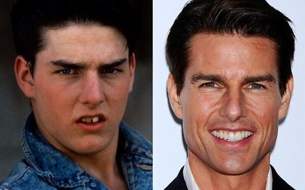 Garsenybių šypsenos: anksčiau ir dabar