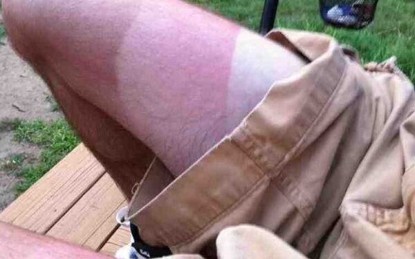 Ir tragiška, ir juokinga: žmonės, kuriems vasara blogesnė nei tau (foto)