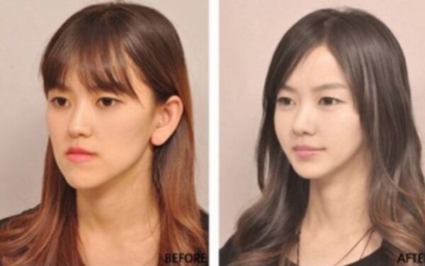 Plastinės chirurgijos pažanga: išduodami žmogaus tapatybę patvirtinantys sertifikatai (foto)