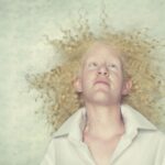 Sergantieji albinizmu - žmonės ir gyvūnai (foto)
