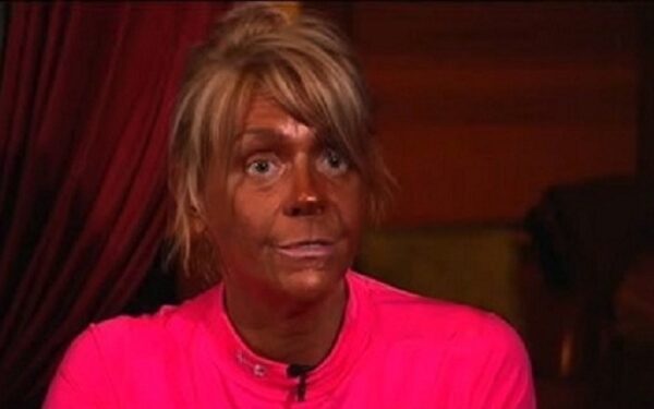 Dirbtinio įdegio maniakė įveikė alkoholizmą, bet ne pomėgį „skrudintis“ (foto)