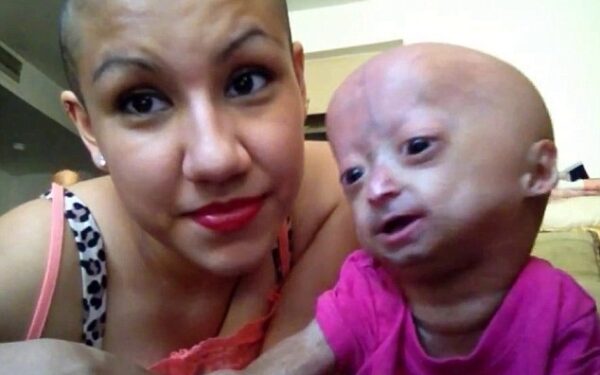 Šešiametė senstančiame kūne: dainuoja „Vanilla ice“, šoka pagal „Gangnam Style“ ir turi gerbėjų klubą