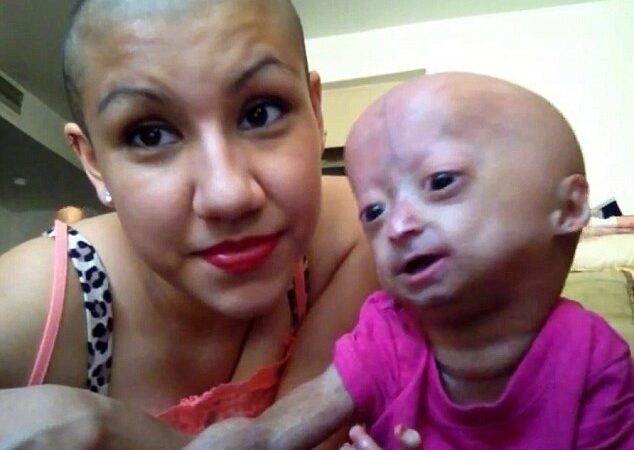 Šešiametė senstančiame kūne: dainuoja „Vanilla ice“, šoka pagal „Gangnam Style“ ir turi gerbėjų klubą