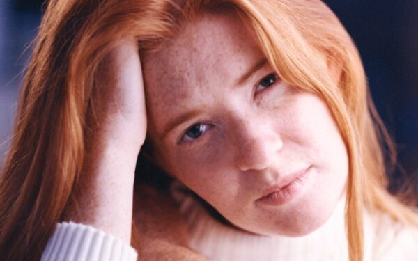 „Ryžaplaukiams“ skauda labiau ir kitos jų bėdos