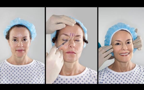 Plastinė chirurgija – ne pramogų, o pavojaus zona