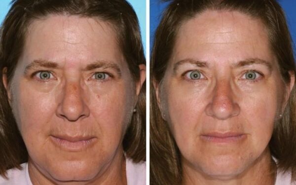 Skaitytojų TOP komentarai (lapkričio1-8 d.): „abidvi geria:D“