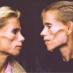 Likimo ironija – identiškų dvynių kovą su anoreksija nutraukė gaisras