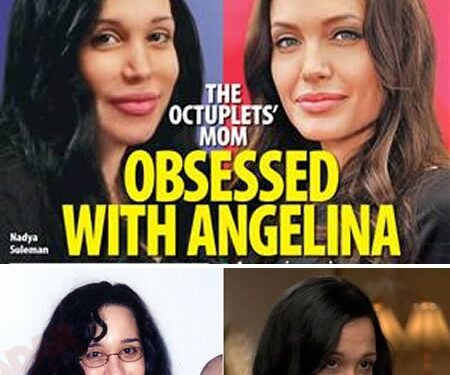 Jie pasidarė plastines operacijas, norėdami tapti kažkuo kitu (foto)