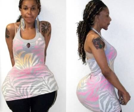 8 katastrofiškų plastinių operacijų aukos (foto)