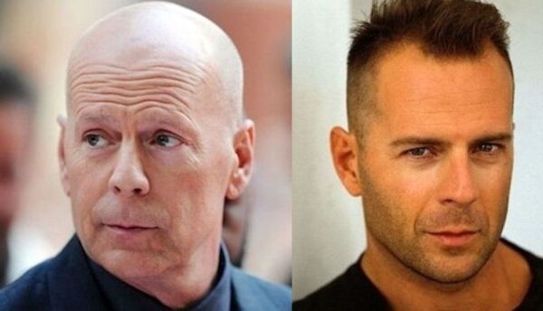 Aktorių išvaizdos pokyčiai: net gražiausieji bei stipriausieji sensta(foto)