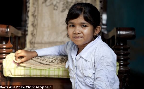 1 m ūgio ir 20 kg svorio 20-metė priversta rengtis vaikiškais drabužiais (foto)