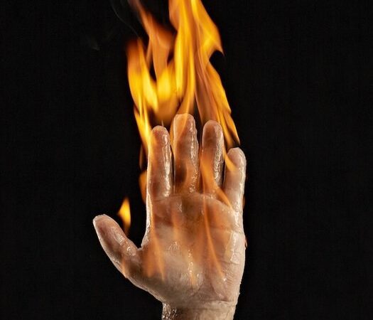 Kaip atliekamas „degančio žmogaus” triukas?