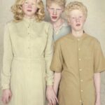 Gražūs ir išskirtiniai: albinosų portretai (foto)