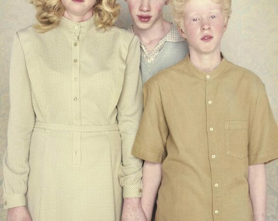 Gražūs ir išskirtiniai: albinosų portretai (foto)