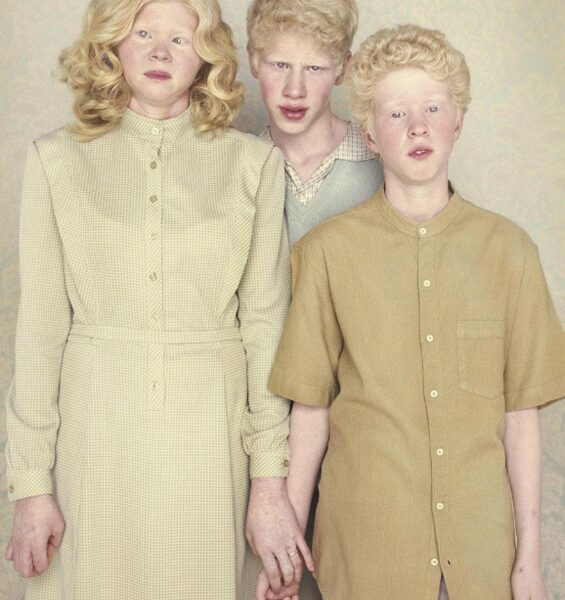 Gražūs ir išskirtiniai: albinosų portretai (foto)