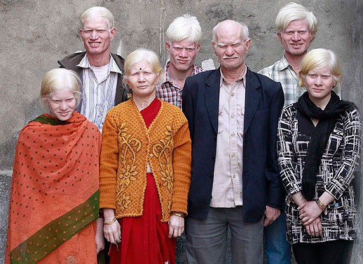 Didžiausia albinosų šeimyna (foto)