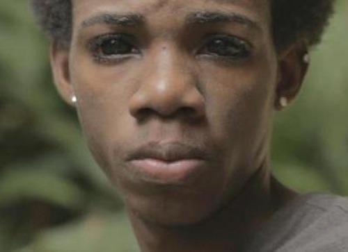Tragiškos pasekmės: jamaikietis išsitatuiravo akies obuolį (foto)