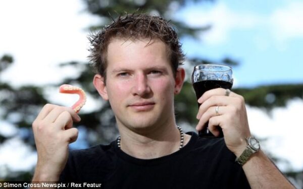 25 metų vyrukas neteko visų dantų, po to kai kasdien išgerdavo po 8 litrus „Coca Colos“