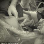 Unikalus kadras - gimdymo metu kūdikis sučiupo daktaro pirštą (foto)