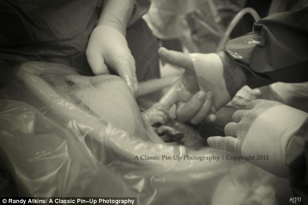 Unikalus kadras - gimdymo metu kūdikis sučiupo daktaro pirštą (foto)