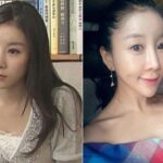 Pietų Korėjos košmarai: po plastinės operacijos mergina liko negrįžtamai sužalota (foto)