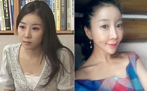 Pietų Korėjos košmarai: po plastinės operacijos mergina liko negrįžtamai sužalota (foto)