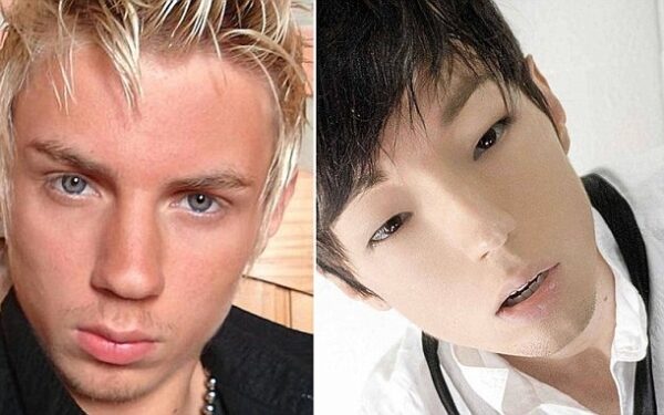 Plastinės operacijos: šviesiaplaukis brazilas siekia atrodyti kaip korėjietis (foto)