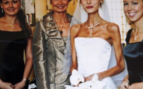 Pabėgimas nuo mirties: moterį nuo anoreksijos išgelbėjo noras būti mama (foto)