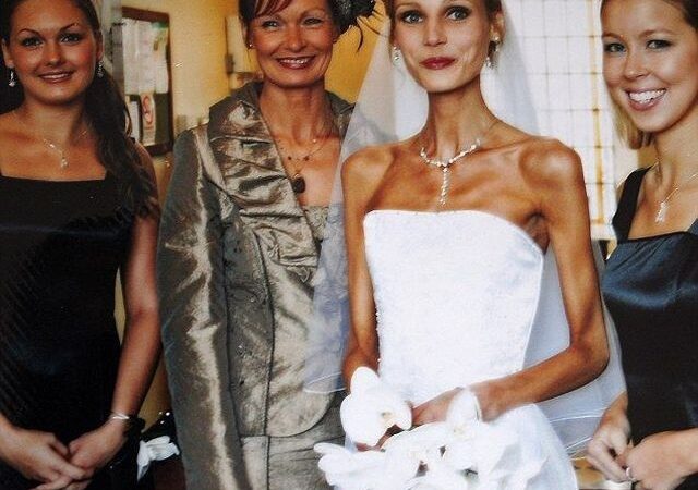 Pabėgimas nuo mirties: moterį nuo anoreksijos išgelbėjo noras būti mama (foto)