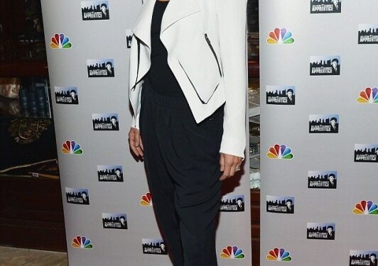 Priklausomybė nuo botokso aktorės lūpas pavertė beformėmis (foto)