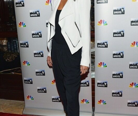 Priklausomybė nuo botokso aktorės lūpas pavertė beformėmis (foto)