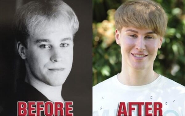 Išprotėjęs pasaulis: tūkstančiai dolerių už Justino Bieberio veidą