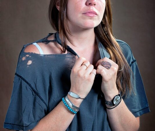 Kai iš meilės lieka tik nudrengti marškinėliai… (foto)