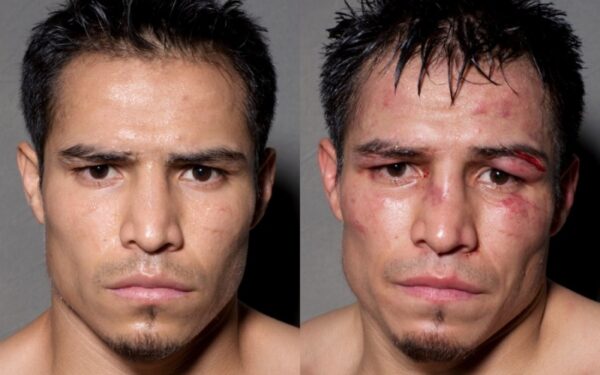 Boksininkų portretai prieš kovą ir po jos (foto)