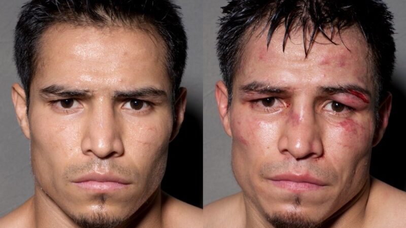 Boksininkų portretai prieš kovą ir po jos (foto)