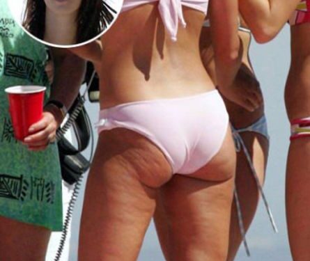 Tobulų nėra: įžymybės reklamoje ir realybėje (II dalis, foto)