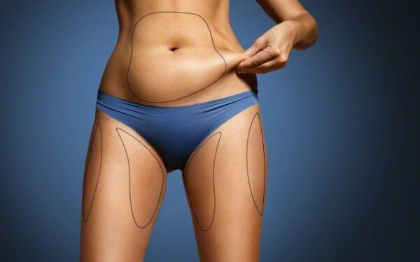 Plastinės operacijos šiandien – prieinamos ne tik turtuoliams