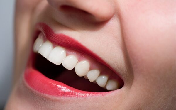 Baliname dantis: kas veiksminga, o kas – kenksminga?