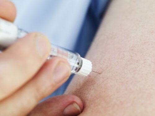 Lietuvoje skelbiama kova su „sėlinančia“ pandemija – diabetu