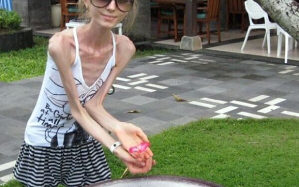 Dietos gali baigtis ir taip… (foto)