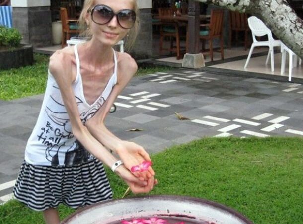 Dietos gali baigtis ir taip… (foto)