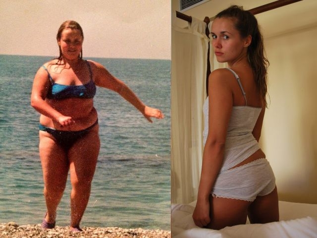 Pokyčiai: pusės savo svorio netekusi mergina nebesidrovi dėvėti maudymosi kostiumėlio (foto)