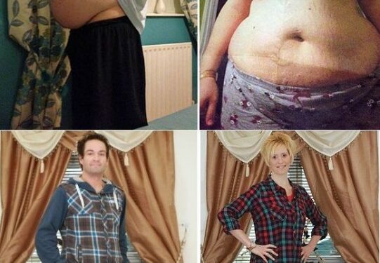 Dviguba sėkmė: pora atsikratė daugiau nei 100 kilogramų (foto)