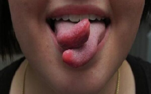 Keistos plastinės operacijos: nuo elfo ausų iki gyvatės liežuvio (foto)